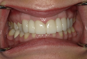 Dr. Nasir General Dentistry | Extractions, Night Guards and Sleep Apnea