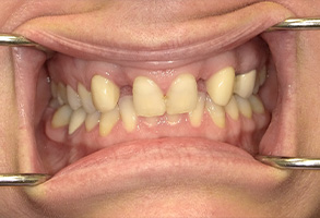 Dr. Nasir General Dentistry | Invisalign reg , Implant Dentistry and Periodontal Treatment