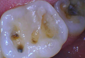 Dr. Nasir General Dentistry | TMJ Disorders, Periodontal Treatment and Snoring Appliances